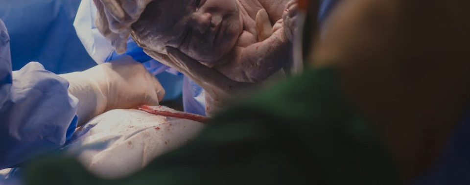 Obstetric Anesthesia Image